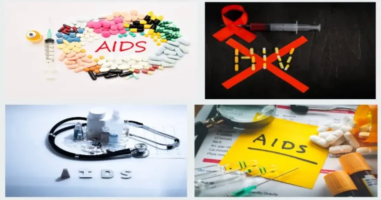 HIV AIDS Symptoms Causes and Treatment