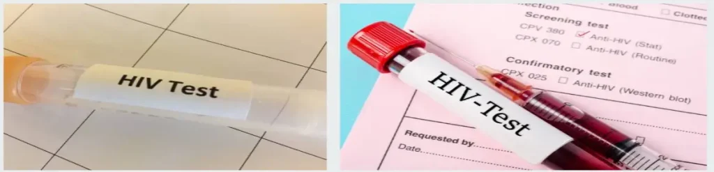 HIV AIDS Symptoms Causes and Treatment: Complete Guide 3 HIV AIDS Testing and Counseling