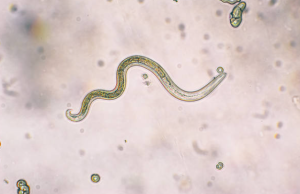 Top 10 Parasitic Diseases  The Ultimate Guide to Symptoms  Risks  Treatments